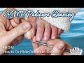 👣ASMR Pedicure Cleaning💆‍♀️How to Fix White Patches on Toenails👣