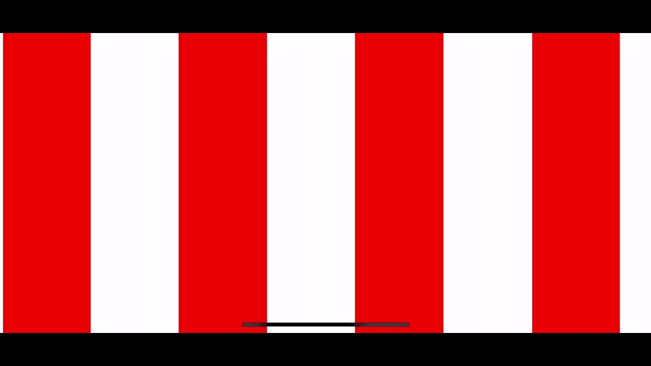 Vestibular Rehabilitation - Right Optokinetic (OPK)