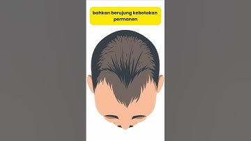 Segera Hentikan Fase Kebotakan Dengan Penumbuh Rambut Alami Ini! #madevine #penumbuhrambut