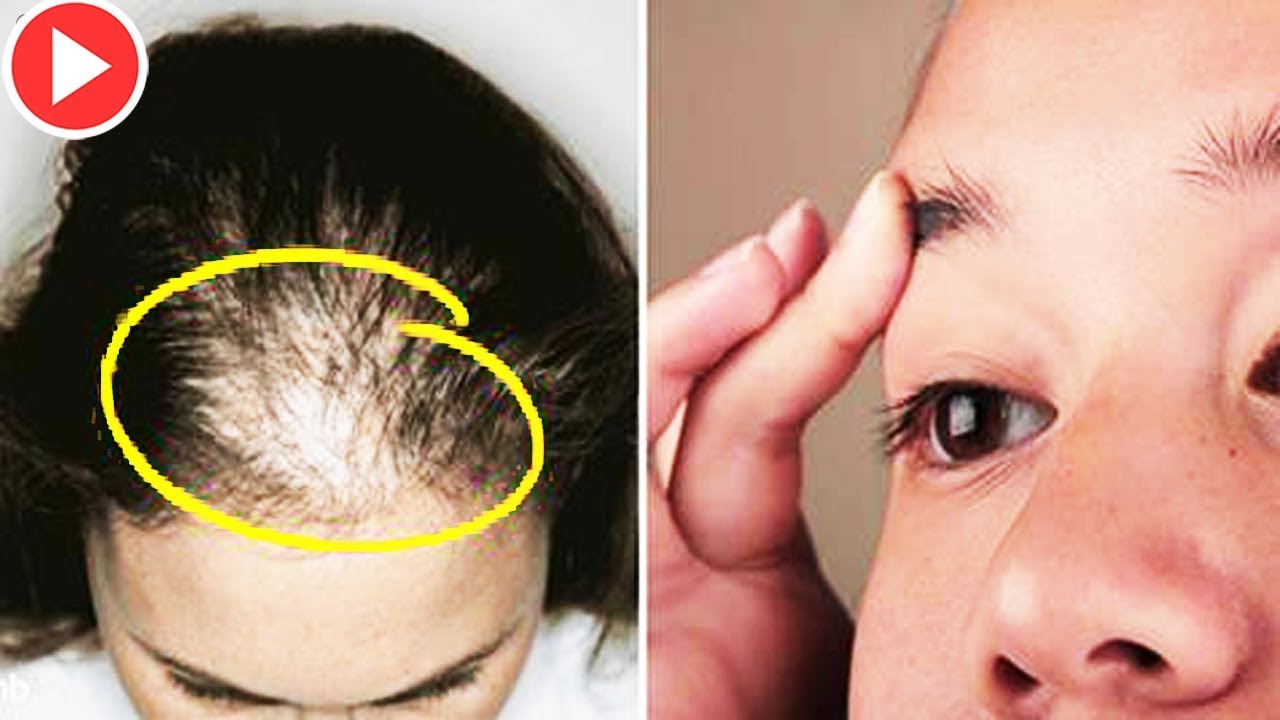 How To Use This Oil to Increase Hair Volume Overnight - Remedies One
