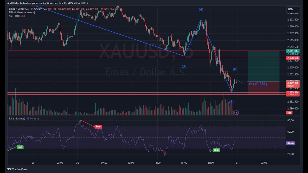 STOP Losing Money in XAUUSD Scalping and WATCH This Live - YouTube