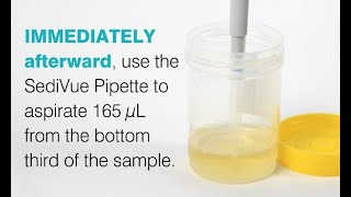 SediVue Dx®: Preparing a Sample With a Pipette
