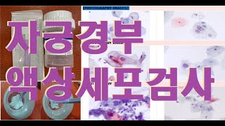 자궁경부  액상  세포검사