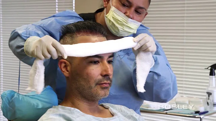 Bosley FUE Procedure Edgar's Journey (Hair Transpl...