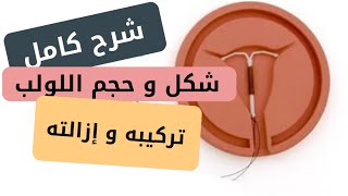 طريقة تركيب اللولب د. ريهام الشال موثقة على اليوتيوب