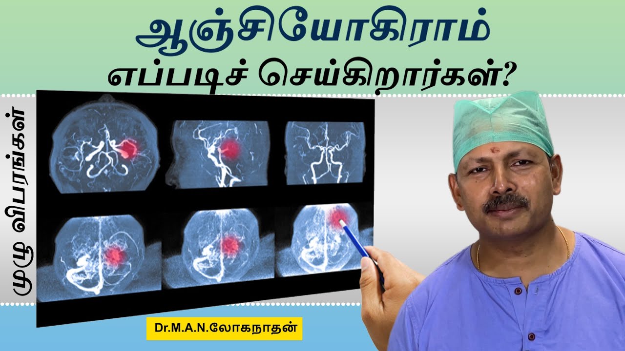 Angiogram procedureஆஞ்சியோகிராம் எப்படிச் செய்கிறார்கள்?முழு விபரங்கள் - Dr Loganathan