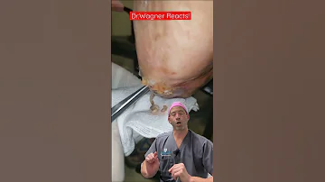MAGGOT THERAPY Shorts Woundcare 