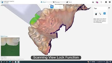 Runyes V3 Pro Dental Intraoral Scanner Function Demo