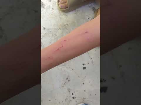 #funny#vid