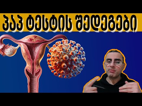 პაპ ტესტი - რატომ უნდა გაიკეთოს ყველა ქალმა პაპ ტესტი