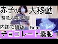 緊急入院9日目‼朝から赤子が大移動の大騒ぎ‼︎チョコレート嚢胞5cm再確認#妊婦 #入院生活