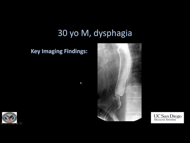 Imaging of esophagus class=