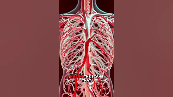 AI Heart Scanner: Your Complete Guide to Artery Insights