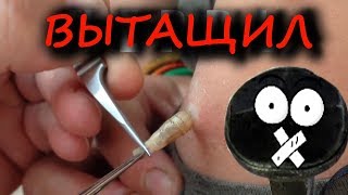 ЧЕРВИ ПОД КОЖЕЙ ДЕВУШКИ ЧЕРВИ ПОД КОЖЕЙ ДЕВУШКИ