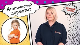 Атопический дерматит Атопический дерматит
