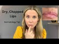 Dry, Chapped Lips: Dermatology tips