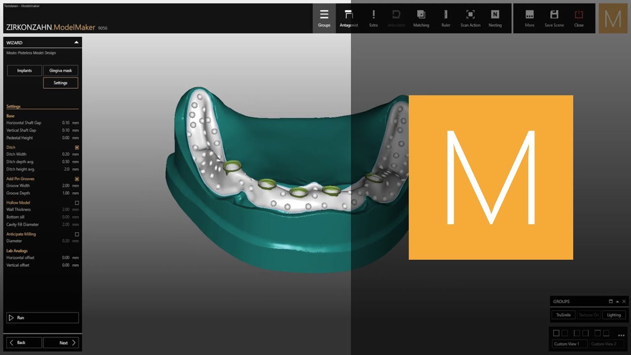 CAD/CAM Model Maker software module | Zirkonzahn.Software - YouTube