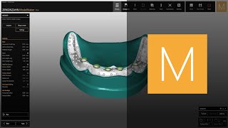 CAD/CAM Model Maker software module | Zirkonzahn.Software screenshot 5