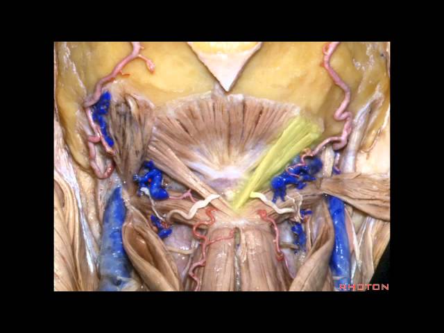 Far Lateral Approach and Jugular Foramen - Part 1 of 2