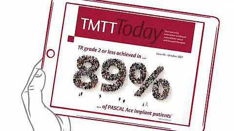 Find out  about the Edwards tricuspid regurgitation valve therapies  | TMTT Today Video