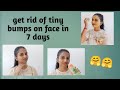 चेहरे के दाने हटायें आसान घरेलू तरीके से 😊get rid of tiny bumps on face.