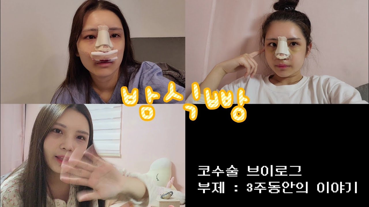 [코수술 브이로그] 3주동안의 이야기 | 코수술 붓기 | 성형외과 상담 꿀팁 | 코수술 리얼후기