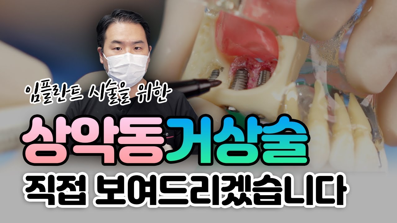 상악동 거상술 | 직접 보여드리겠습니다!