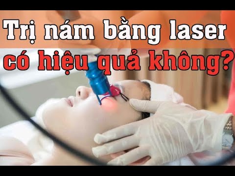 Trị nám bằng
