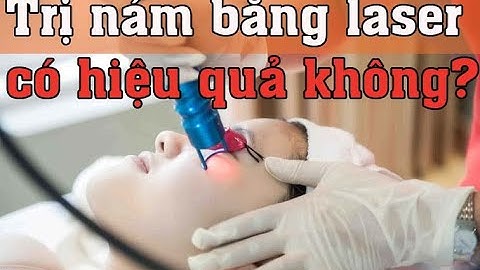 Trị nám bằng laser có hiệu quả?