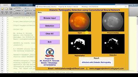 How to develop Diabetic Retinopathy Detection using Convolutional Neural Network CNN matlab project