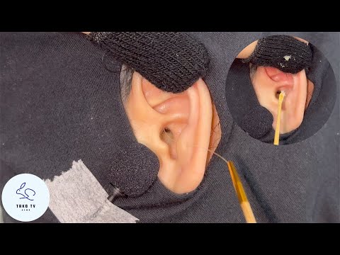 ASMR Real Ear Cleaning: Brain Melting Itching Sound 耳掃除 귀청소 采耳