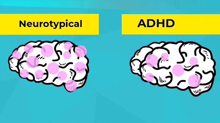 Infographics: What is ADHD?