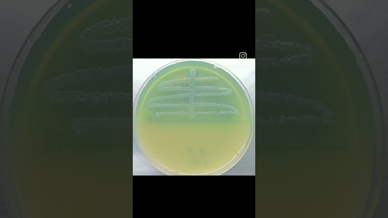 Escherichia coli bacteria is causes mainly UTIs.Its appears yellowish colonies on Cled agar medium.