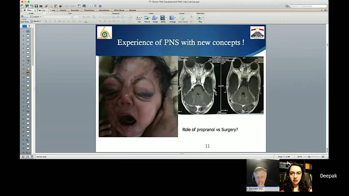 Day 1: "Pediatric Neurosurgery": Video 1