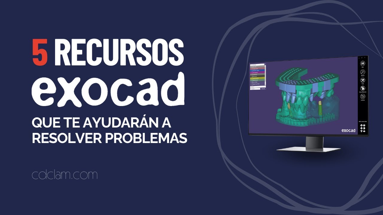 5 Recursos de Exocad que te ayudarán a solucionar problemas