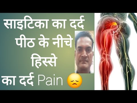 Pain Rana Yoga for Sciatica pain - YouTube