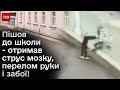 😲 Скандал у школі у Василькові! Учень штовхнув дітей з висоти! Струс мозку, перелом руки і забої!