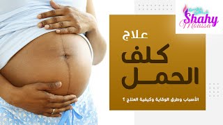 وصفة طبيعية لعلاج الكلف ؟ فى أيام فقط