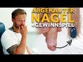 Gelnägel - Abgekauten Nagel wieder schick machen mit Schablone - Tutorial