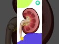 pathari ki samasya #shorts #youtbeshorts #kidneystone #shortsfeed #kidney