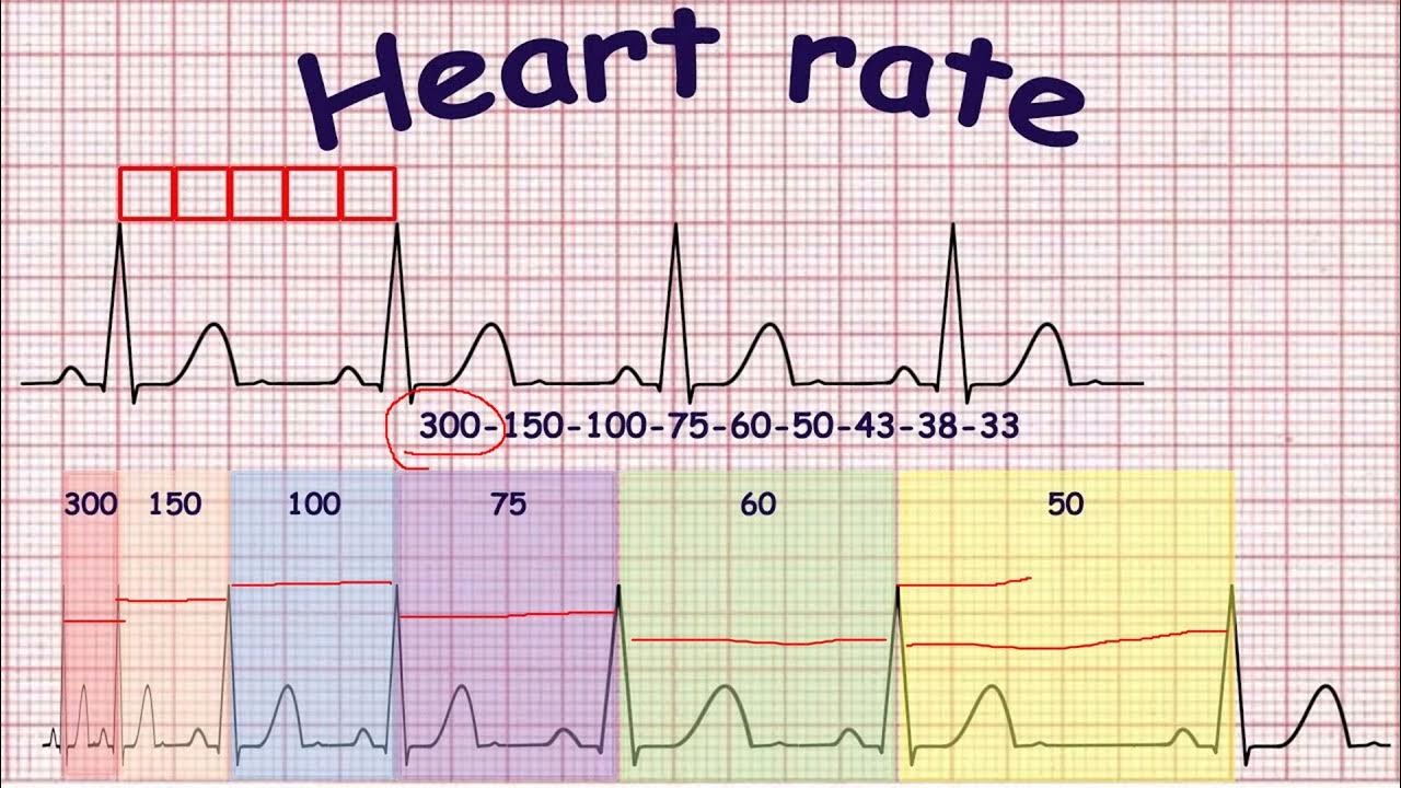 Heart Rate Calculation in ECG II Regular & Irregular heart rate calculation YouTube
