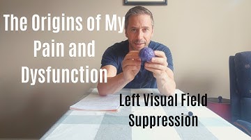 The Origin of My Pain Discovered: Suppression of My Left Visual Field