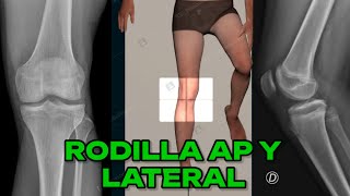 RADIOGRAFÍA DE RODILLA AP Y LATERAL (MANUAL DE BOLSILLO) #7 screenshot 4