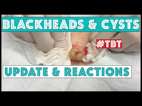 Update On Some Favorite Pops:  With Patient Reactions To Their Videos!