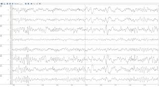 Sleep under pressure - EEG of Lukas Kaufmann during Race across America 2025