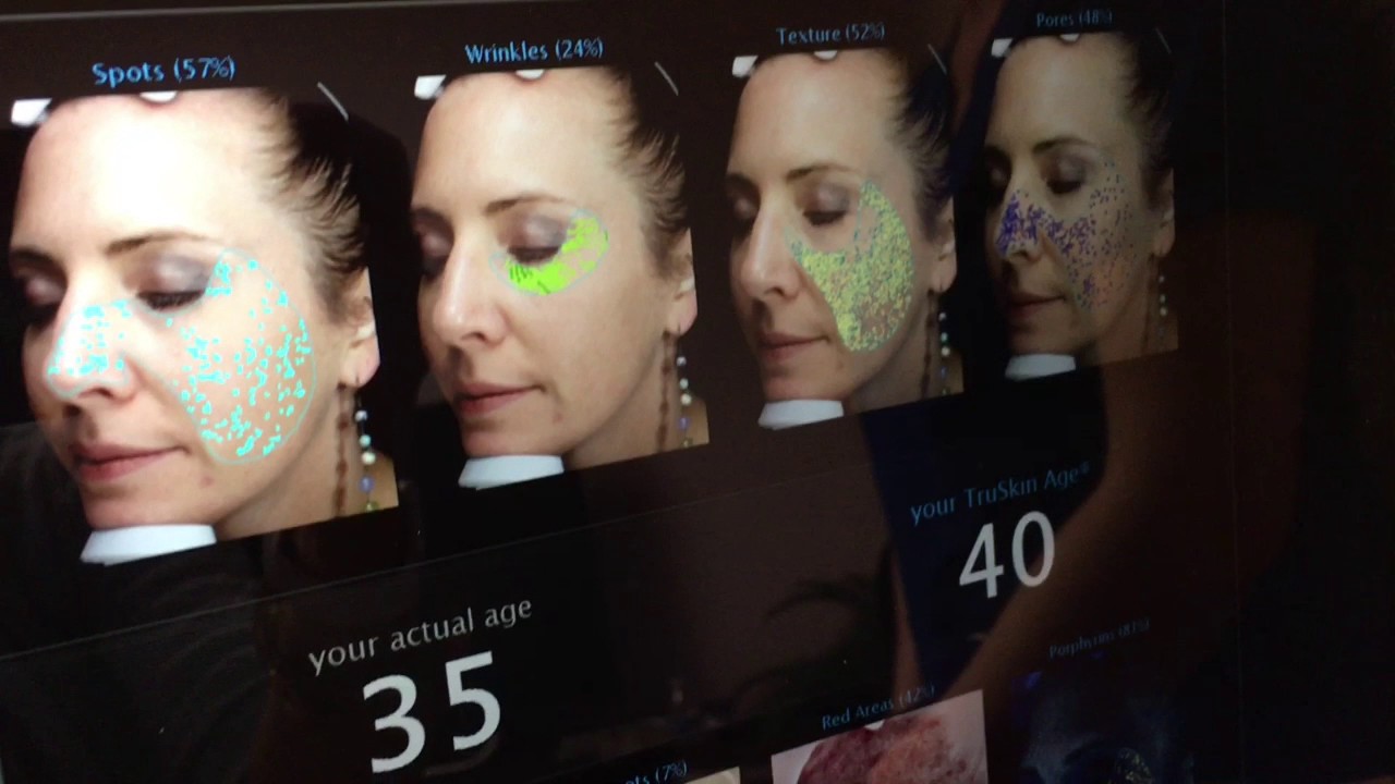 Review Visia Facial Analysis YouTube