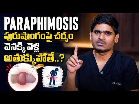 అంగంపై ఈ సమస్య నిర్లక్ష్యం చేయొద్దు | Paraphimosis Symptoms and Treatment | Treatment Range