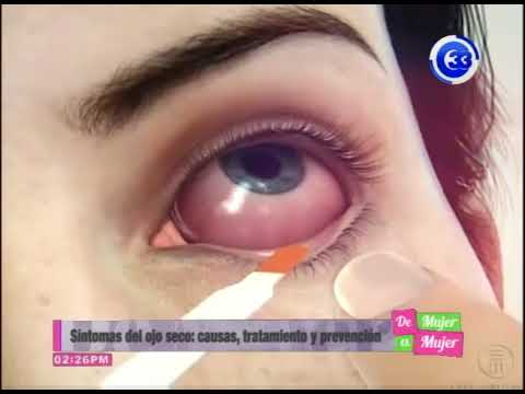 sintomas de tener el ojo seco