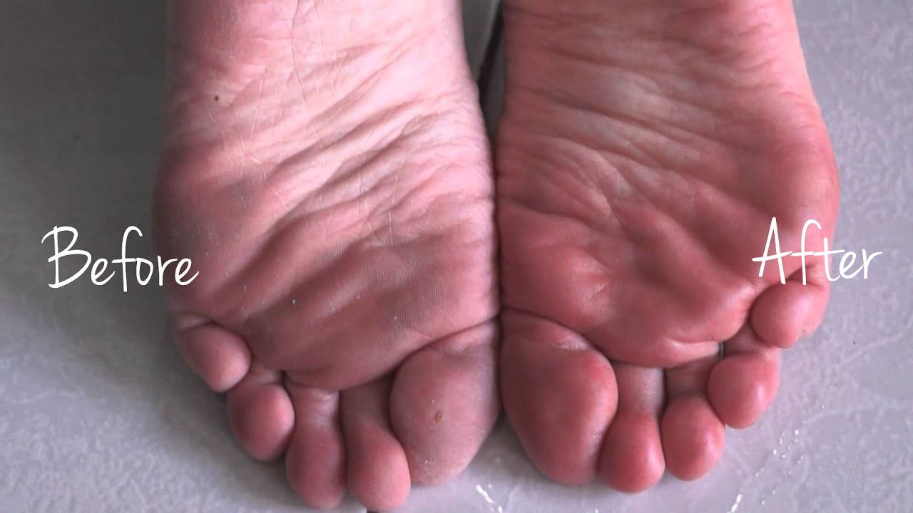 How To Care For Your Feet An Awesome Velvet Smooth Device Youtube