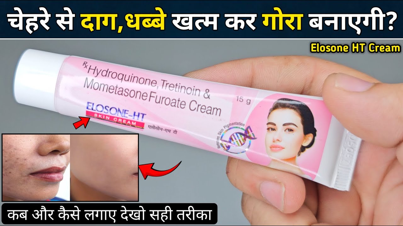 Elosone Ht Skin Cream | elosone ht skin cream kaise use kare | elosone ht cream